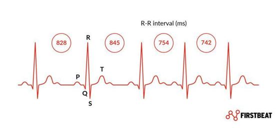 心率变异性(HRV)-RR间隔